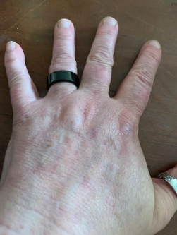 Client 1 avec Smart Ring